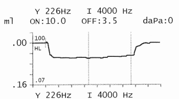 Normal Acoustic Delay