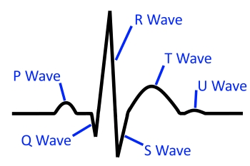 ECG Complex