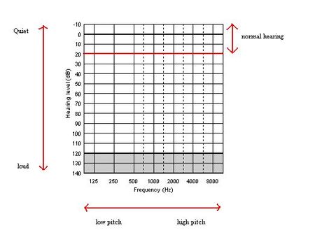 Blank Audiogram