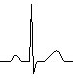 ECG