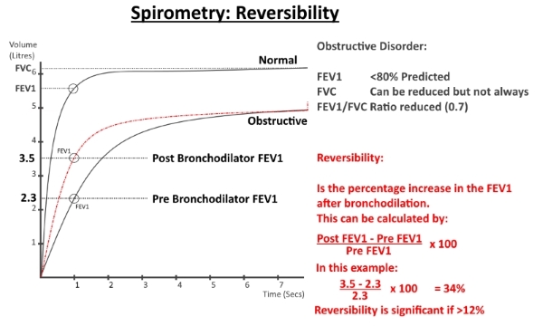 Reversibility