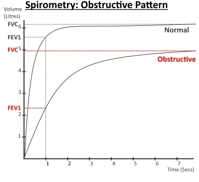 Obstructive PAttern