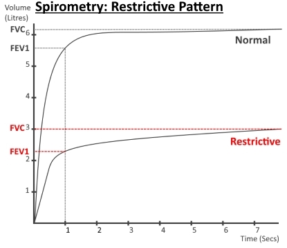 Restrictive Pattern