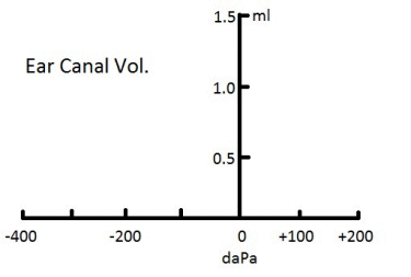 Tympanogram