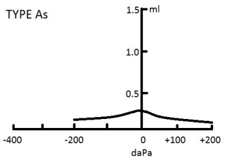 Type As Tympanogram