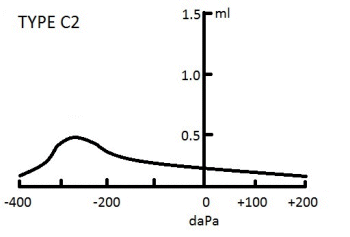 Type C2 Tympanogram