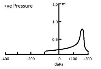Positive Tympanogram